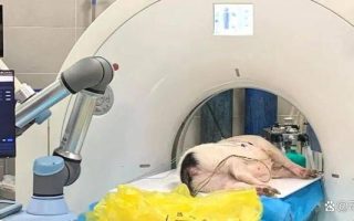 进军精准治疗，推想医疗首发AI手术机器人